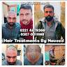 Hair Treatments By Naveed